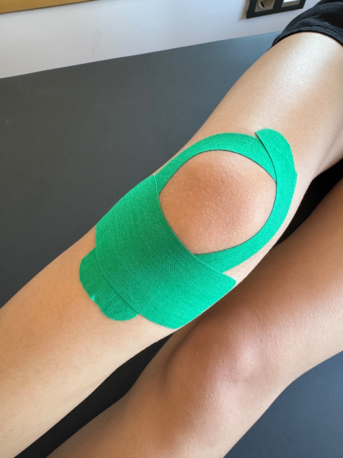 Kinezyolojik Bantlama (Kinesio Tape)